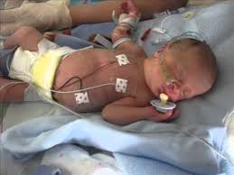 Dreamstime is the world`s largest stock photography community. Our Precious Baby Boy 10 Weeks Premature At 30 Weeks Youtube
