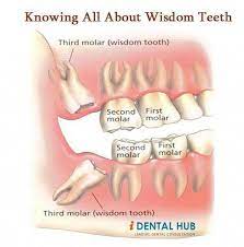 Rhetorical Sensitive Teeth Cold Toothpastedispensermurah Clearchoicedentalimplantscost Odontologia