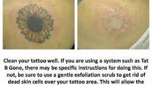 Laser removal (burning the tattoo away), surgical removal (cutting the tattoo away), dermabrasion (sanding the skin with a wire brush. How To Remove A Tattoo With Home Remedies Tattoo Removal Ideas Youtube