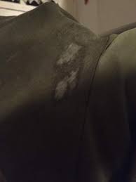 Habe auch eingetrocknete kotze aus dem hemd und jeans bekommen. Harte Deoflecken Entfernen Wasche