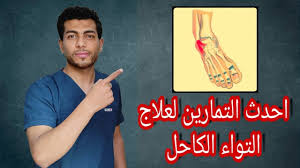 علاج التواء الكاحل وتورمه Youtube