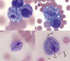 Image result for trichomonas images