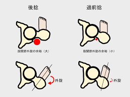 骨格によるスクワットフォームの違いと対策 体幹 大腿 下腿 股関節 bluezzly スクワット フォーム 股関節