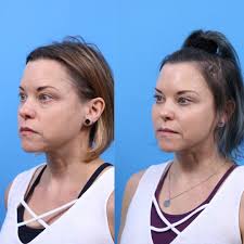 Dr. Evan Beale, where luxury meets excellent care. ✨ 1️⃣ From the moment  you step into our space, you're met with personalized care and attention to  detail. Dr. Beale takes the time