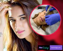 Celeb Skin Care Erica Fernandes Shared Her First Dermafrac Experience For Black Heads And White Heads