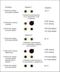 The Enright Phenomenon Stereoscopic Distortion Of Perceived