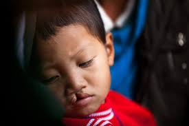 A second chance to smile