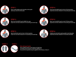 Hidow Placement Chart Ems 400 Muscle Stimulator Manual