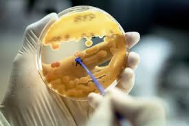 If We Can Grow Bacteria In A Lab, Why Do We Only Know About 1% Of Them? » ScienceABC