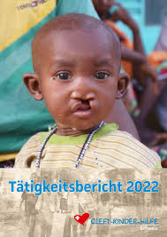 Über uns — Cleft-Kinder-Hilfe Schweiz