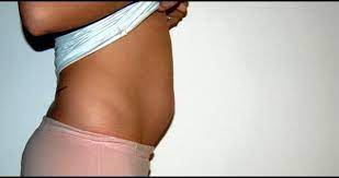 Endometriose Entre Amigas Porque Voce Anda Inchada Um Belo Dia Voce Se Olha No Espelho E Mas Noticias Voltou O Inchaco Mas Fique Calma Porque Sao Poucas As Mulheres Que Nao
