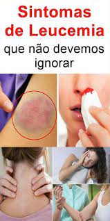 É uma doença dos glóbulos brancos (leucócitos), e muitas vezes, sua origem é desconhecida. Pin On Saude