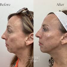 Abby Redwine BSN, RN (@abby_lavidamedspa) • Instagram photos and videos