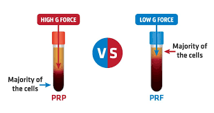 A prf file is a user profile referenced by microsoft outlook that contains user information and preferences. Platelet Rich Fibrin Does It Have A Future In Implant Dentistry Gp Implant Ltd