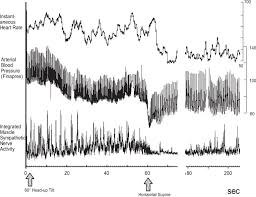 The impact of trauma on mental and physical health the vagusnerve, the gut's microbiome, heart rate variability (hrv). Progression Of Vasovagal Syncope From Stage I To Iii Download Scientific Diagram