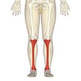 Image result for icd 10 code for tib/fib fracture