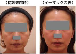 カルミア美肌クリニック