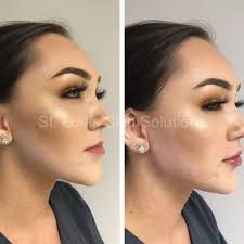 THE BEST 10 DERMATOLOGISTS near SAPPINGTON, MO 63128