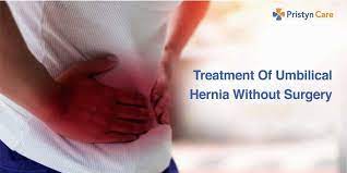 Physical therapy can to some extent remedy this injury but severe cases will require surgery. 3 Ways To Treat Umbilical Hernia Without Surgery Pristyn Care