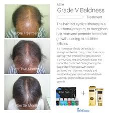 The health of your hair depends on how you care for it and maintain it. Facebook