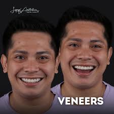 𝐀𝐧𝐧𝐨𝐮𝐧𝐜𝐞𝐦𝐞𝐧𝐭: 𝐃𝐫. 𝐉𝐞𝐛 𝐁𝐞𝐧𝐞𝐝𝐢𝐜𝐭 𝐋𝐨𝐩𝐞𝐳'𝐬  𝐋𝐨𝐧𝐠 𝐋𝐞𝐚𝐯𝐞 𝐟𝐨𝐫 𝐒𝐭𝐮𝐝𝐢𝐞𝐬 Dear Valued Patients, We hope  this message finds you in good health and high spirits. Today, we would  like to inform you about