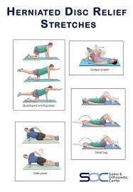 Maintaining a healthy weight could prevent back. Herniated Disc