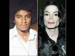 The number of people getting cosmetic procedures has risen steadily over the past five years and there are several reasons why. 8 Worst Celebs Changed Drastically After Plastic Surgery Gone Wrong Before And After Photos