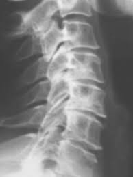 The first, second, and seventh vertebrae are extraordinary, and are detailed later. Epos Trade