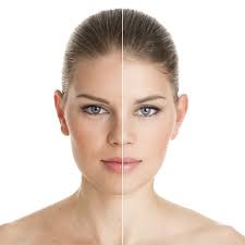 THE BEST 10 LASER HAIR REMOVAL in STERLING HEIGHTS, MI