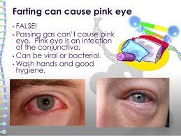 Can You Get Pink Eye From A Fart? | Longevity