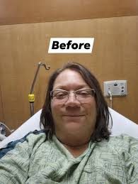 Recovery from bariatric surgery was challenging