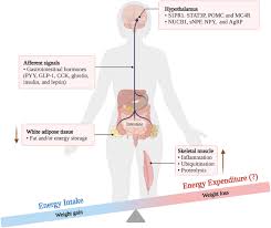 Image result for Cachexia in Cancer