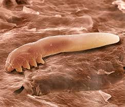Image result for Demodex folliculorum