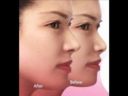#coolblog offers something no one else does: Nose Up Clipper Asli Alat Pemancung Hidung Alami Youtube