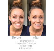 Is the Dermocol Full Coverage Foundation acne safe?