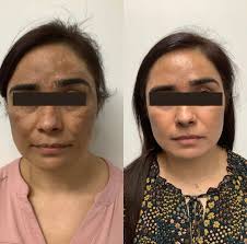 Dr. Balwant Singh's Skin Clinic