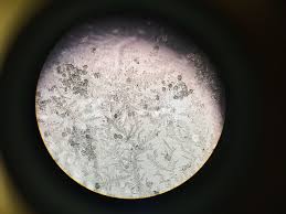 Image result for Vaginal Pooling