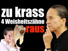 Der weisheitszahn (synonyma dritter molar, lateinisch dens sapiens, dens serotinus ‚spät kommend') ist von der mitte aus gezählt der achte zahn im menschlichen gebiss. Weisheitszahne Entfernen Alle Auf Einmal Oder Lieber Separat Dr Andrea Jacob