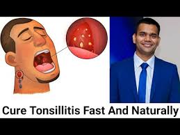 Don't meet your friends or relatives and avoid talking to. How To Cure Tonsillitis Fast And Naturally Powerful Home Remedies For Tonsil Stones That Works Fast Youtube