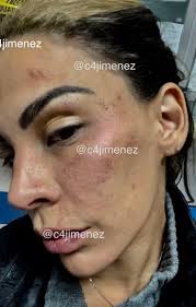 Esta es una forma en la que me quiero acercar más a todas mis. They Filter The Strong Images Of The Blows That Eleazar Gomez Inflicted On His Girlfriend Tefi Valenzuela Photo English Mundo Hispanico