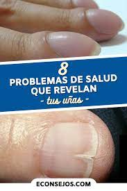 8 Problemas De Salud Que Revelan Las Unas Segun Su Forma Color Y Textura Salud De Las Unas Enfermedades En Las Unas Cura Hongos En Las Unas