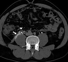 Image result for Genitourinary Trauma