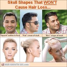This hair loss tends to sneak up on women slowly and only becomes more severe and worse if not treated right away. Domed Shaped Head Your Skull Shape Is What Causes Hair Loss