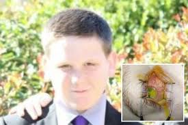 Boy nearly eats himself BLIND before mum discovers his diet was responsible  for his declining vision