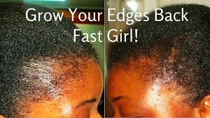 A lot of women who choose to grow out their natural hair are impatient, especially if they do the big chop and have to rock a twa for the next couple of months. Who Did This Weaves Severely Damage Hair Amazing Hair Transformations Youtube