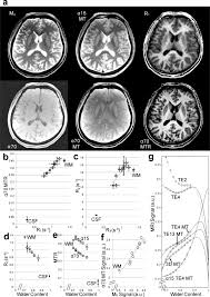 Flair sagittal, gradient echo, t2, flair and diffusion axial plus t1 axial and sagittal with and without contrast, as well as t1 coronal post infusion. Magnetic Resonance Imaging Of Brain Cell Water Scientific Reports