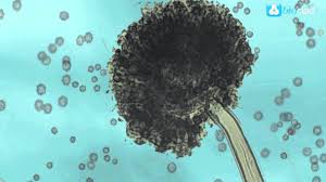 It causes a disease called black mold on certain fruits and vegetables such as grapes, apricots, onions, and peanuts, and is a common contaminant of food. Preventing Aspergillus Niger In Healthcare Environments Youtube