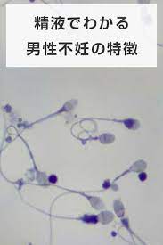 男性不妊の特徴 見た目でわかるなりやすい人 男性不妊 不妊 妊娠初期