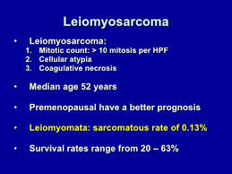 Leiomyosarcoma Disease Of Peri Menopaual Age Mitosis Cancer