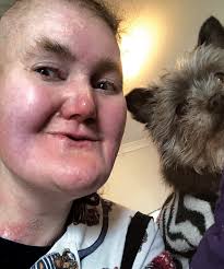 OCCUPATIONAL THERAPY